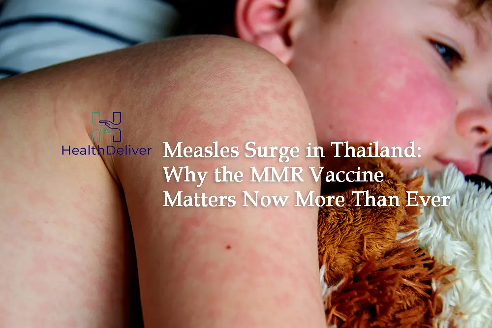 Measles Surge Hits Thailand: Measles, Mumps, and Rubella (MMR) Vaccine
