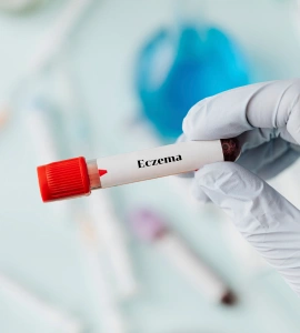 Eczema Comprehensive Panel