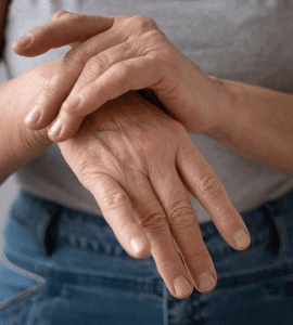 Autoimmune Arthiritis Panel