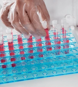 Complete Organic Acids Test