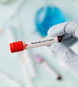 Reticulocyte Count