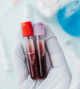 Custom Blood Test (Home Service - 7 Items) 10Feb2025