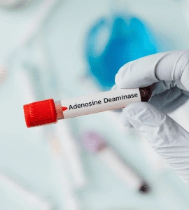 Adenosine Deaminase Test