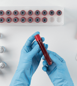 Heavy Metals Check up